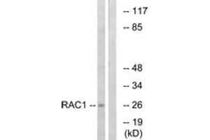 Western blot analysis of extracts from NIH-3T3 cells, treated with EGF 200ng/ml 30', using Rac1/CDC42 (Ab-71) Antibody. (RAC1+CDC42 (AA 38-87) antibody)
