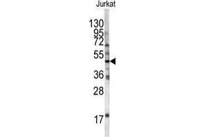 Western blot analysis of HFE antibody (Center) in Jurkat cell line lysates (35 µg/lane).