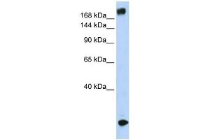 SCN5A antibody used at 1 ug/ml to detect target protein. (SCN5A antibody  (N-Term))
