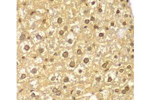 Immunohistochemistry of paraffin-embedded Mouse liver using ASC / TMS1 Polyclonal Antibody at dilution of 1:100 (40x lens). (PYCARD antibody)