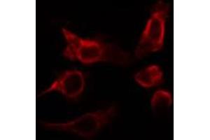 ABIN6266795 staining HepG2 cells by IF/ICC. (RHOBTB2 antibody)