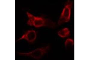 ABIN6266795 staining HepG2 cells by IF/ICC.