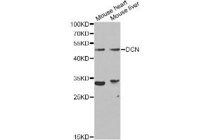 Western blot analysis of extracts of various cell lines, using DCN Antibody (ABIN5970829) at 1/1000 dilution. (Decorin antibody)