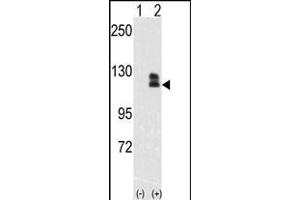 Western blot analysis of EphB2(arrow) using rabbit polyclonal EphB2 Antibody (ABIN391921 and ABIN2841731).