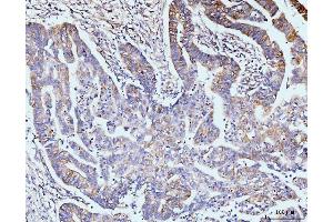 IHC analysis of GIT1 using anti-GIT1 antibody (ABIN7601683). (GIT1 antibody  (AA 415-736))