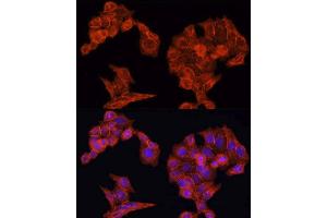 Immunofluorescence (IF) image for anti-Epidermal Growth Factor Receptor (EGFR) (AA 1021-1210) antibody (ABIN6139974)