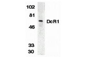 Western Blotting (WB) image for anti-Tumor Necrosis Factor Receptor Superfamily, Member 10c (TNFRSF10C) (Extracellular Domain) antibody (ABIN1030834) (DcR1 antibody  (Extracellular Domain))
