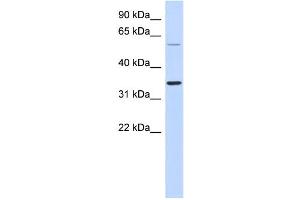 WB Suggested Anti-SASP Antibody Titration: 0. (ASPRV1 antibody  (Middle Region))