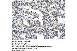 Rabbit Anti-AGER Antibody  Paraffin Embedded Tissue: Human Lung Cellular Data: Alveolar cells Antibody Concentration: 4. (RAGE antibody  (C-Term))