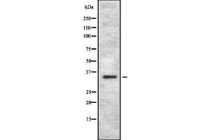 Western blot analysis OR4C12 using HuvEc whole cell lysates (OR4C12 antibody  (Internal Region))