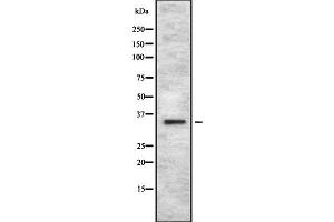 OR4C12 antibody  (Internal Region)