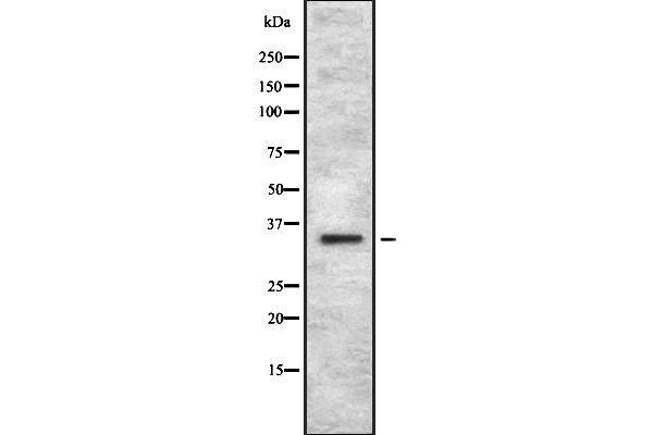 OR4C12 antibody  (Internal Region)