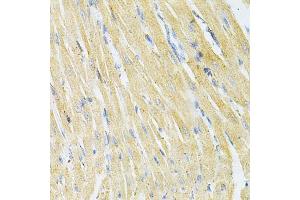 Immunohistochemistry of paraffin-embedded rat heart using GLRX Antibody (ABIN1876503) at dilution of 1:200 (40x lens). (Glutaredoxin 1 antibody)