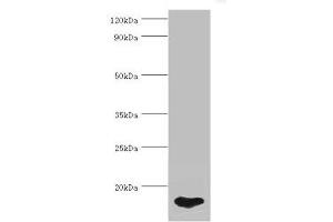 Western blot All lanes: FABP5 antibody at 5 μg/mL + HepG2 whole cell lysate Secondary Goat polyclonal to rabbit IgG at 1/10000 dilution Predicted band size: 15 kDa Observed band size: 15 kDa (FABP5 antibody  (AA 1-135))
