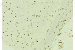 ABIN6276692 at 1/100 staining Mouse brain tissue by IHC-P. (Retinoblastoma Binding Protein 4 antibody  (C-Term))
