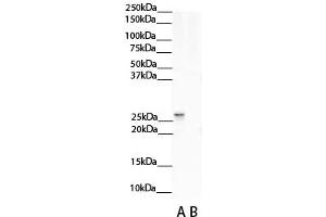 Western Blotting (WB) image for anti-Nicotinamide N-Methyltransferase (NNMT) (N-Term) antibody (ABIN2775335)