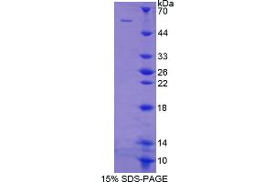 Image no. 1 for Docking Protein 3 (DOK3) (AA 128-385) protein (His tag,GST tag) (ABIN6238258) (DOK3 Protein (AA 128-385) (His tag,GST tag))