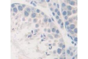 Figure. (SEMA5B antibody  (AA 36-161))