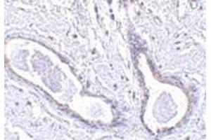 Immunohistochemistry of CCDC98 in human breast tissue with CCDC98 antibody at 5 μg/ml. (CCDC98 antibody  (N-Term))