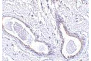 Immunohistochemistry of CCDC98 in human breast tissue with CCDC98 antibody at 5 μg/ml.