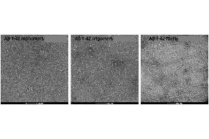 Electron Microscopy (EM) image for Amyloid beta (Abeta) protein (ABIN7272125)