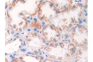 DAB staining on IHC-P;;Samples: Human Kidney Tissue (GLUD1 antibody  (AA 334-556))