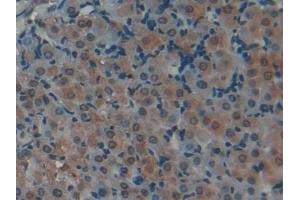 Detection of H3 in Rat Ovary Tissue using Polyclonal Antibody to Histone H3 (H3) (Histone 3 antibody  (AA 1-136))