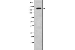 Western blot analysis of KIF13B using K562 whole cell lysates