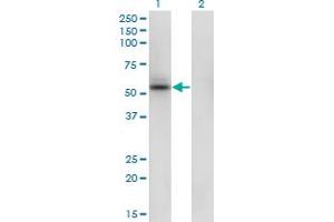 Western Blot analysis of SHMT1 expression in transfected 293T cell line by SHMT1 monoclonal antibody (M01), clone 4F9.