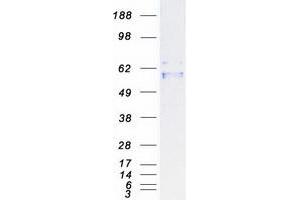 Western Blotting (WB) image for Purinergic Receptor P2X, Ligand Gated Ion Channel 2 (P2RX2) (Transcript Variant 1) protein (Myc-DYKDDDDK Tag) (ABIN2728083)