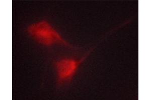 ABIN6267367 staining K562 cells by ICC/IF. (BCR antibody  (pTyr360))