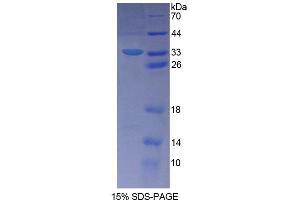 SDS-PAGE (SDS) image for Schlafen Family Member 5 (SLFN5) (AA 658-891) protein (His tag) (ABIN4991099) (SLFN5 Protein (AA 658-891) (His tag))