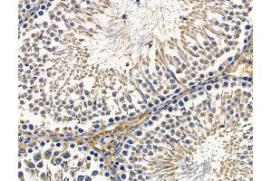 ABIN7096357 and ABIN7100419 at 1/100 staining rat testis tissue by IHC-P.