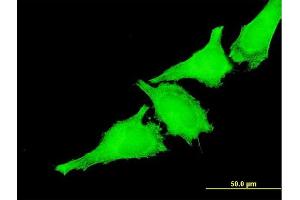 Immunofluorescence of monoclonal antibody to TAOK3 on HeLa cell. (TAO Kinase 3 antibody  (AA 809-898))