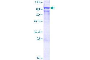 RNGTT Protein (AA 1-597) (GST tag)