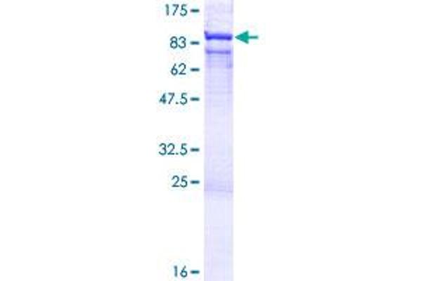 RNGTT Protein (AA 1-597) (GST tag)