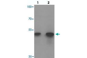 Western blot analysis of ACSL1 in human lung tissue with ACSL1 polyclonal antibody  at (1) 1 and (2) 2 ug/mL.