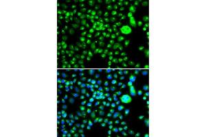 Immunofluorescence analysis of MCF-7 cells using SMCHD1 antibody. (SMCHD1 antibody  (AA 1756-2005))