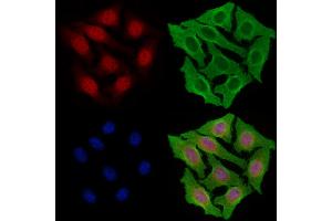 ABIN7094485 and ABIN7098534 staining Hela cells by IF/ICC. (KDM6A antibody  (Internal Region))