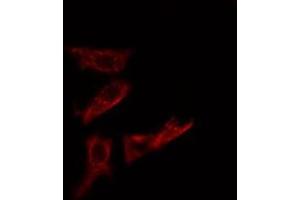 ABIN6276011 staining Hela cells by IF/ICC. (GPR142 antibody  (Internal Region))