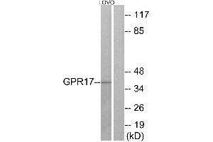 Western blot analysis of extracts from LOVO cells, using GPR17 antibody. (GPR17 antibody  (Internal Region))