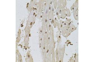 Immunohistochemistry (Paraffin-embedded Sections) (IHC (p)) image for anti-Epidermal Growth Factor Receptor (EGFR) (AA 1021-1210) antibody (ABIN6139974)