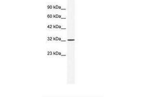 Image no. 2 for anti-Small Nuclear RNA Activating Complex, Polypeptide 2, 45kDa (SNAPC2) (AA 197-246) antibody (ABIN202273)