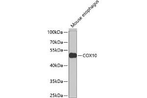 Western blot analysis of extracts of mouse esophagus, using COX10 Antibody (ABIN6133361, ABIN6138907, ABIN6138908 and ABIN6223449) at 1:1000 dilution. (COX10 antibody  (AA 1-160))