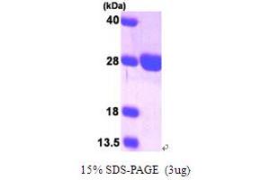 SDS-PAGE (SDS) image for Surfeit 1 (SURF1) (AA 80-273) protein (His tag) (ABIN666926)