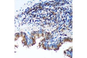 Immunohistochemistry of paraffin-embedded Rat lung using FBXO21 Rabbit pAb (ABIN7267085) at dilution of 1:100 (40x lens). (FBXO21 antibody  (AA 440-621))