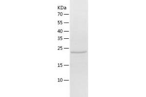 Western Blotting (WB) image for Desmoplakin (DSP) (AA 78-300) protein (His tag) (ABIN7285448) (Desmoplakin Protein (DSP) (AA 78-300) (His tag))