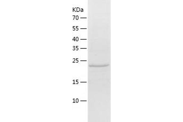Desmoplakin Protein (DSP) (AA 78-300) (His tag)
