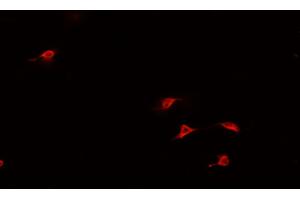 ABIN6266944 staining U-2 OS cells by IF/ICC. (HAND1 antibody  (Internal Region))