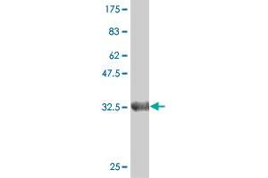 Western Blot detection against Immunogen (35. (Deoxyguanosine Kinase antibody  (AA 1-89))